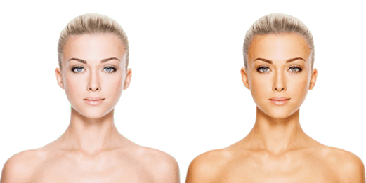 Identical woman not tanned right and tanned on left